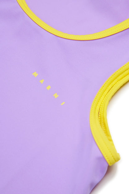 Contrast trim cover-up